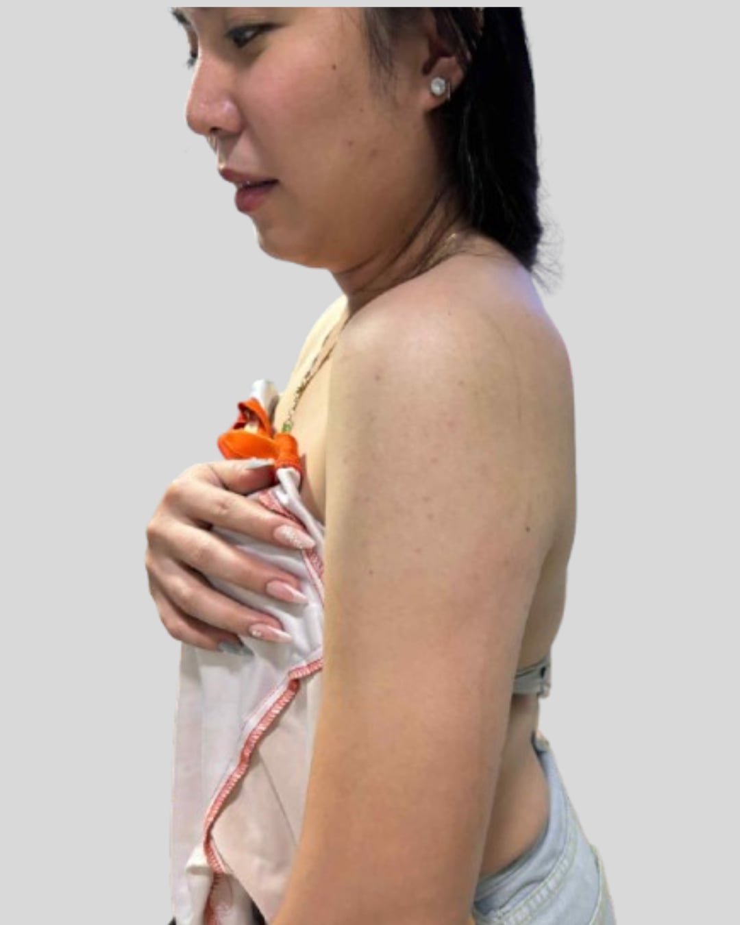 Barbie Arms (Botox) - Home Service